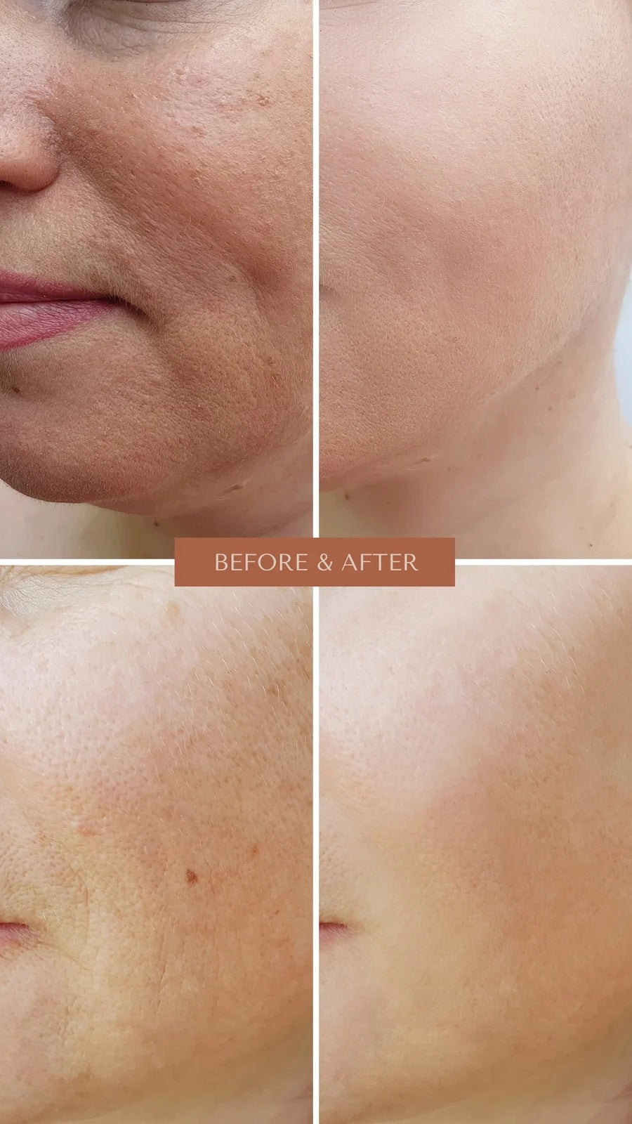 Skin Lightening Serum