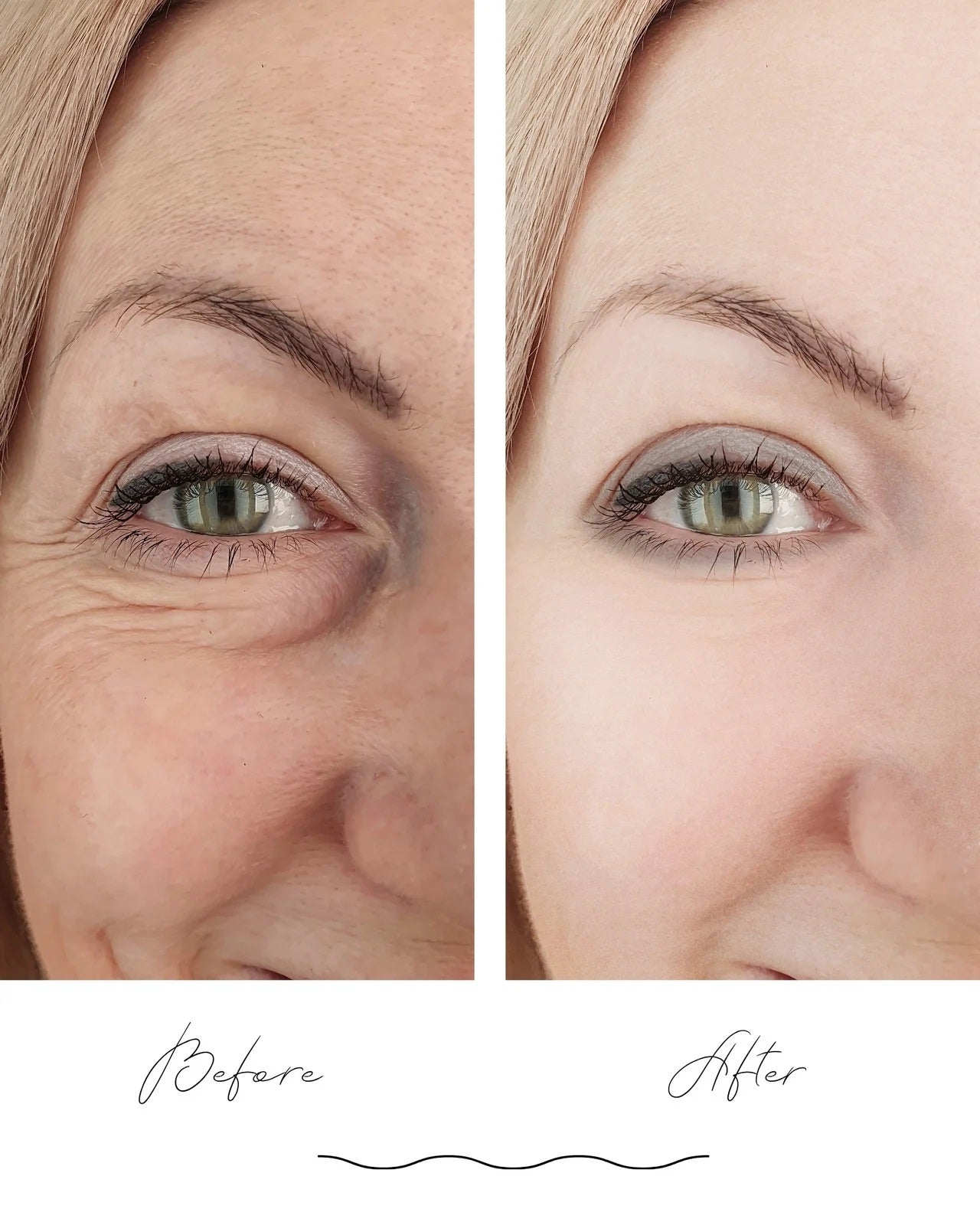 Anti Aging Vitamin-C Serum