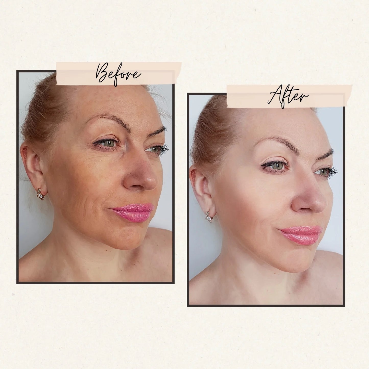 Anti Aging Vitamin-C Serum